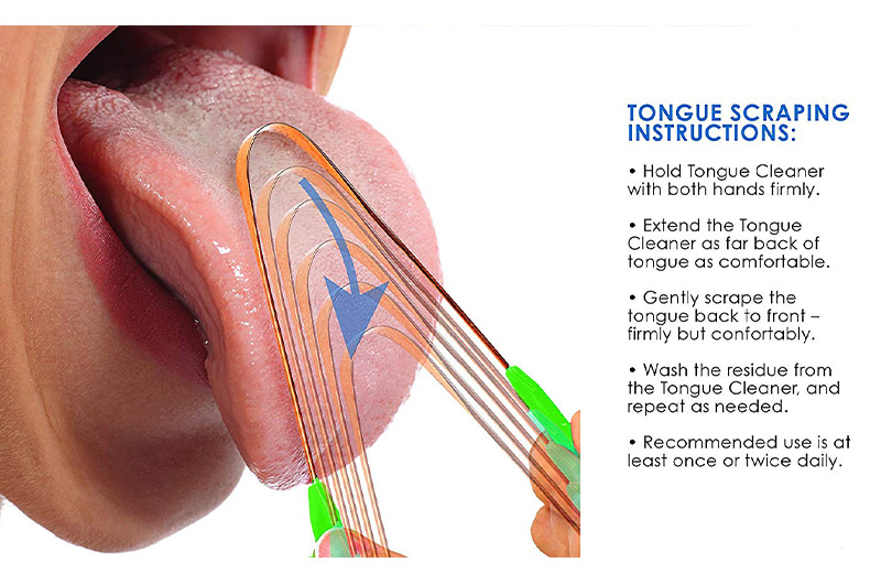 tongue scrapers